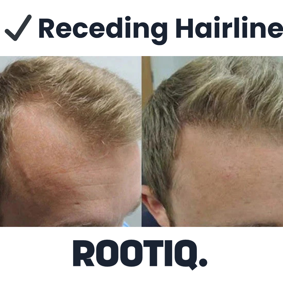 Hairline Reviver