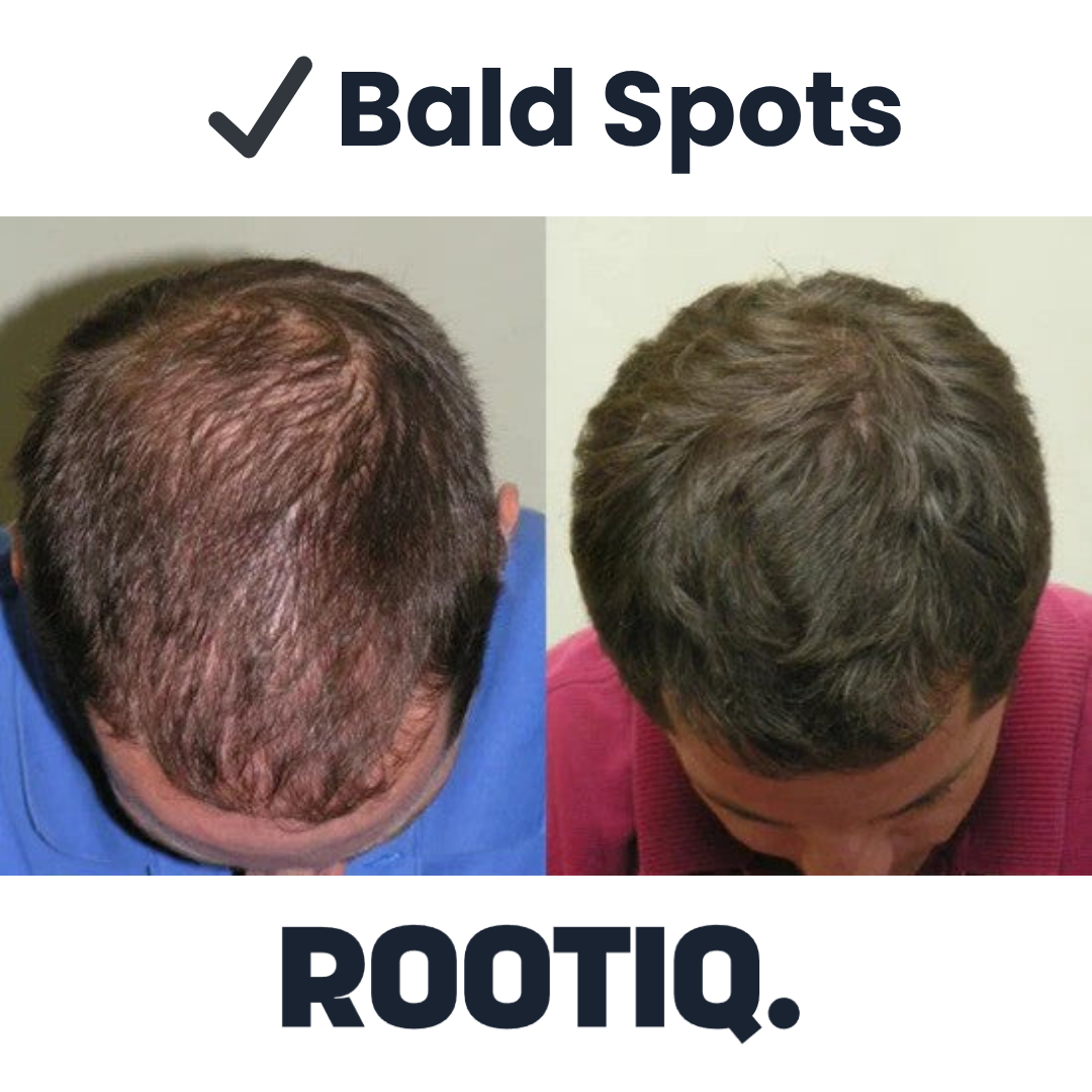 Hairline Reviver