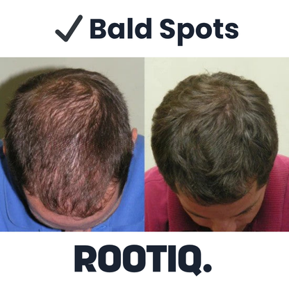 Hairline Reviver