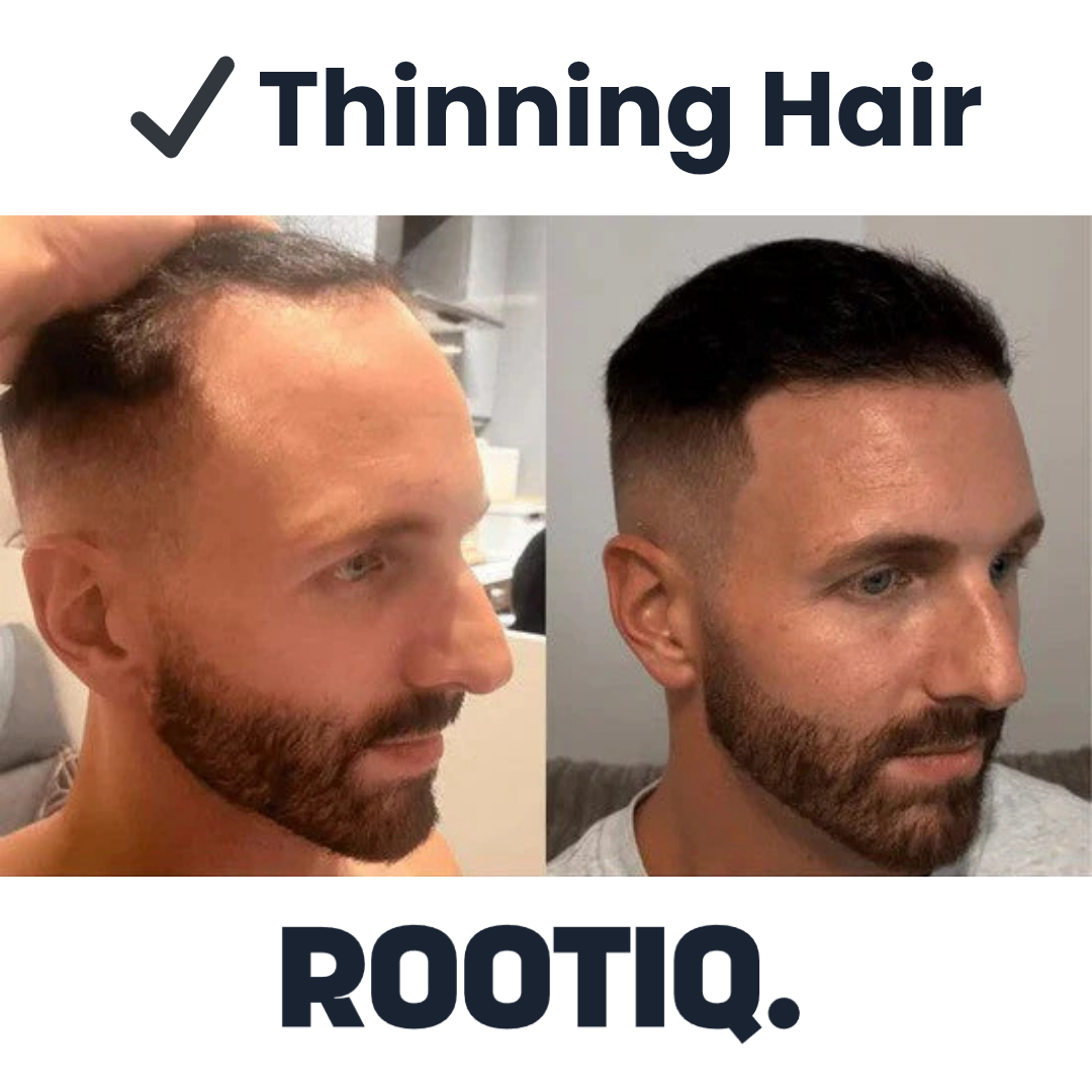 Hairline Reviver